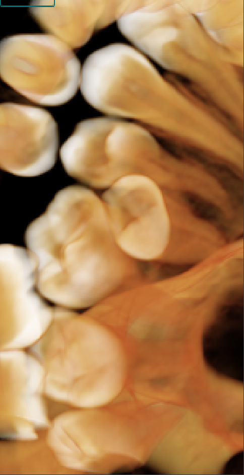 Detalle óseo y dental